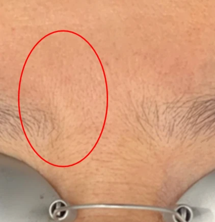 before_image