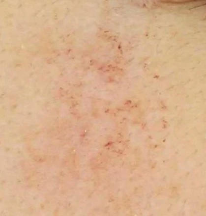before_image