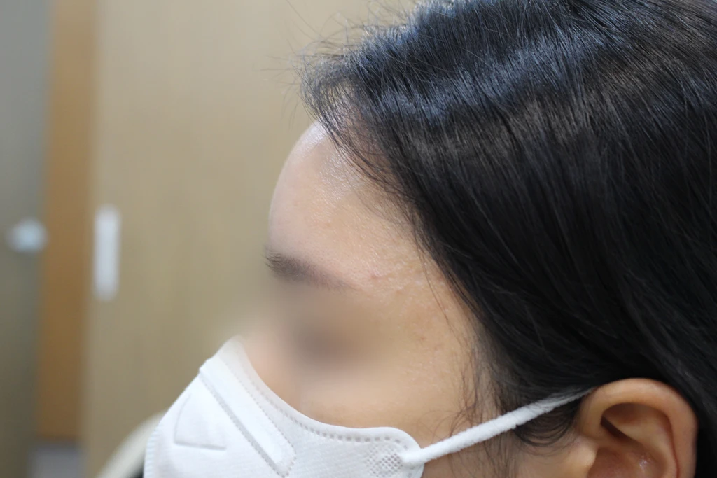before_image