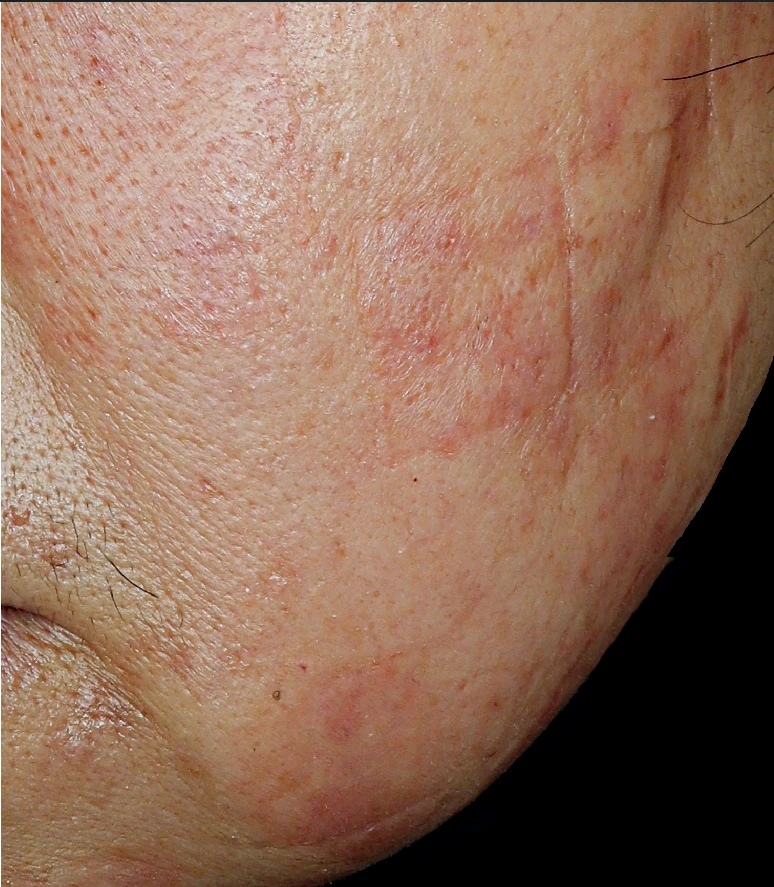 before_image
