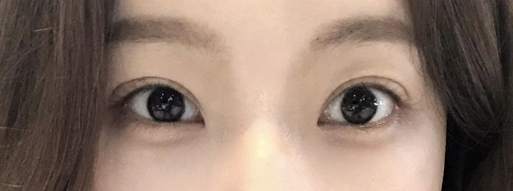 before_image