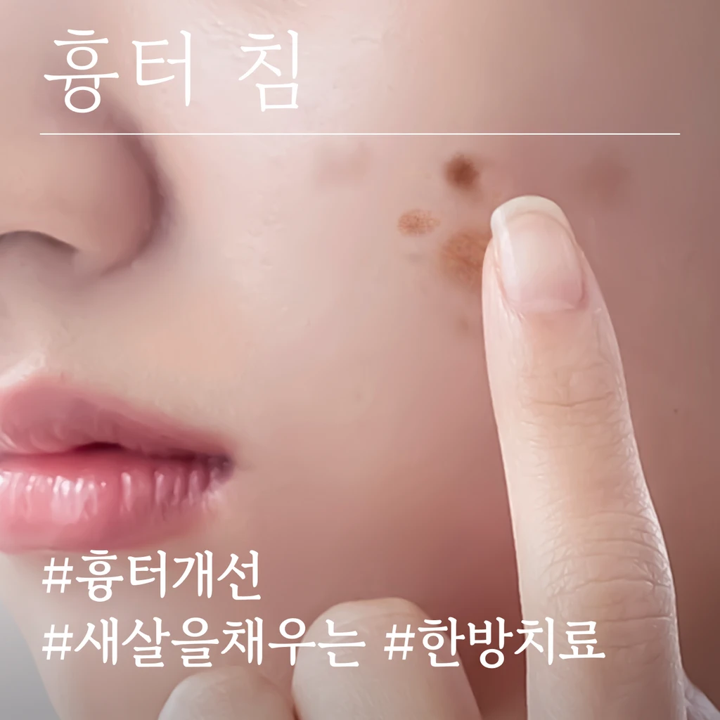 event thumbnail image