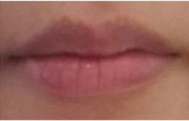 before_image
