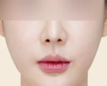 before_image