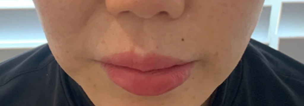 before_image
