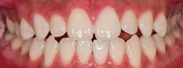 before_image