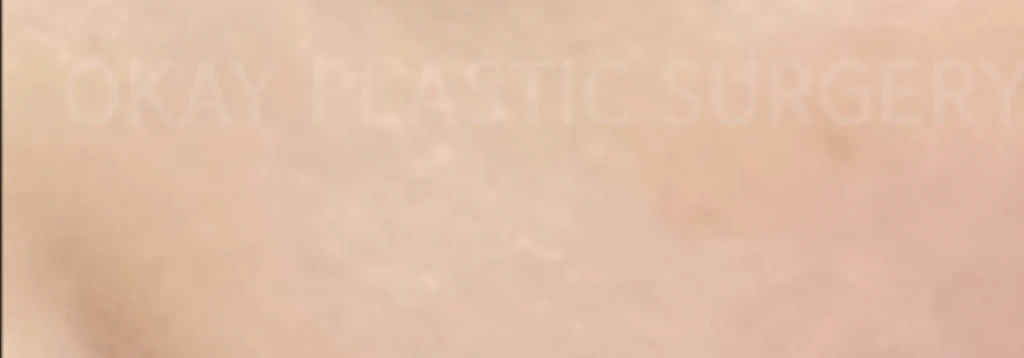 before_image