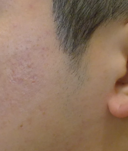 before_image