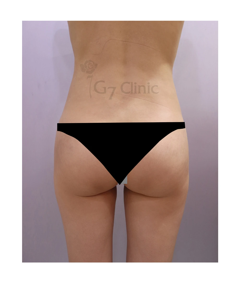 before_image