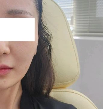 before_image