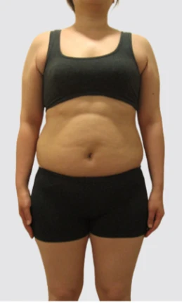 before_image