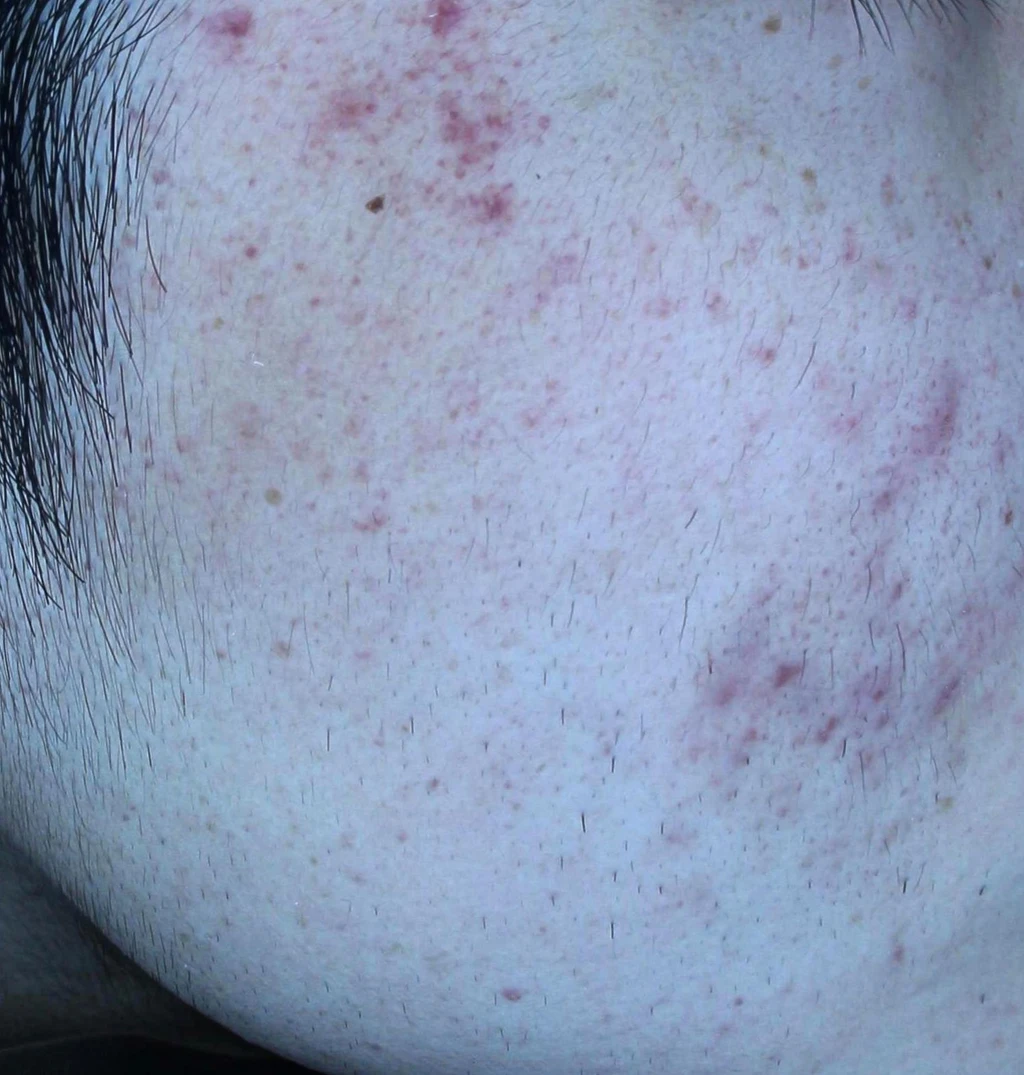 before_image