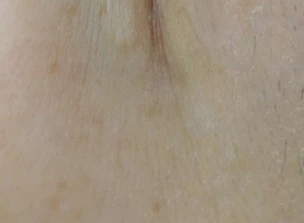 before_image