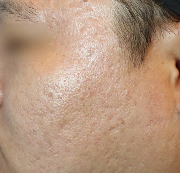 before_image