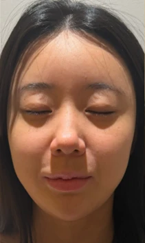 before_image