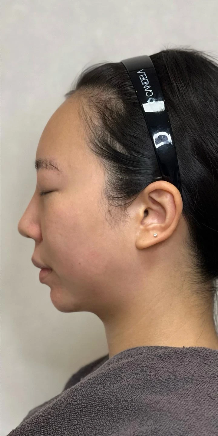 before_image