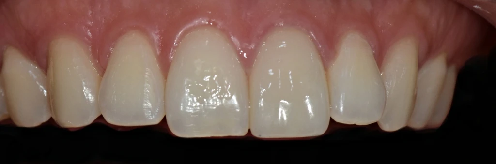before_image