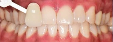 before_image