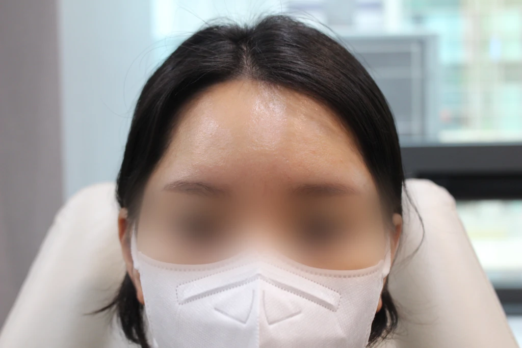 before_image