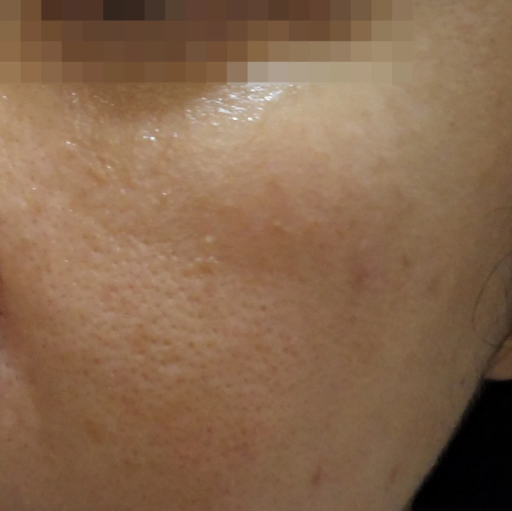before_image