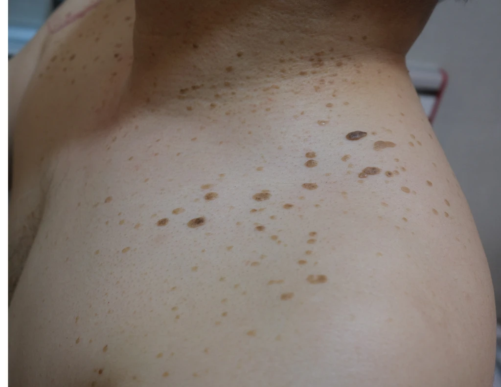 before_image