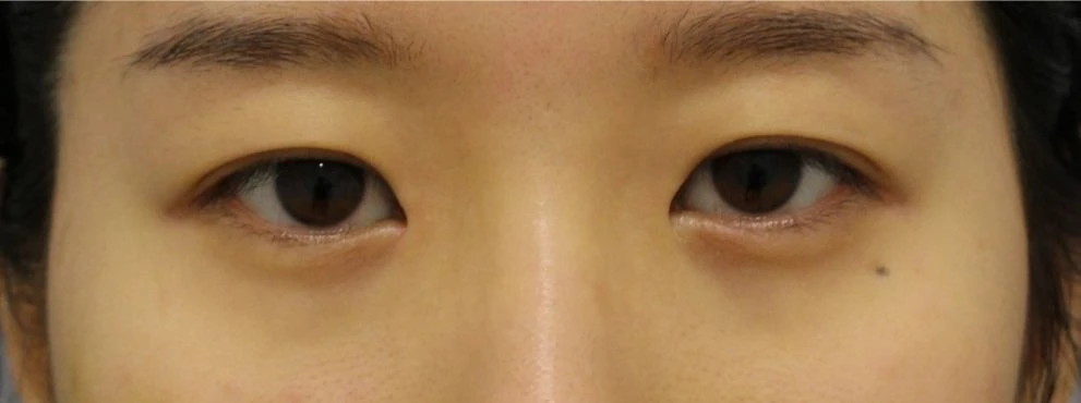 before_image