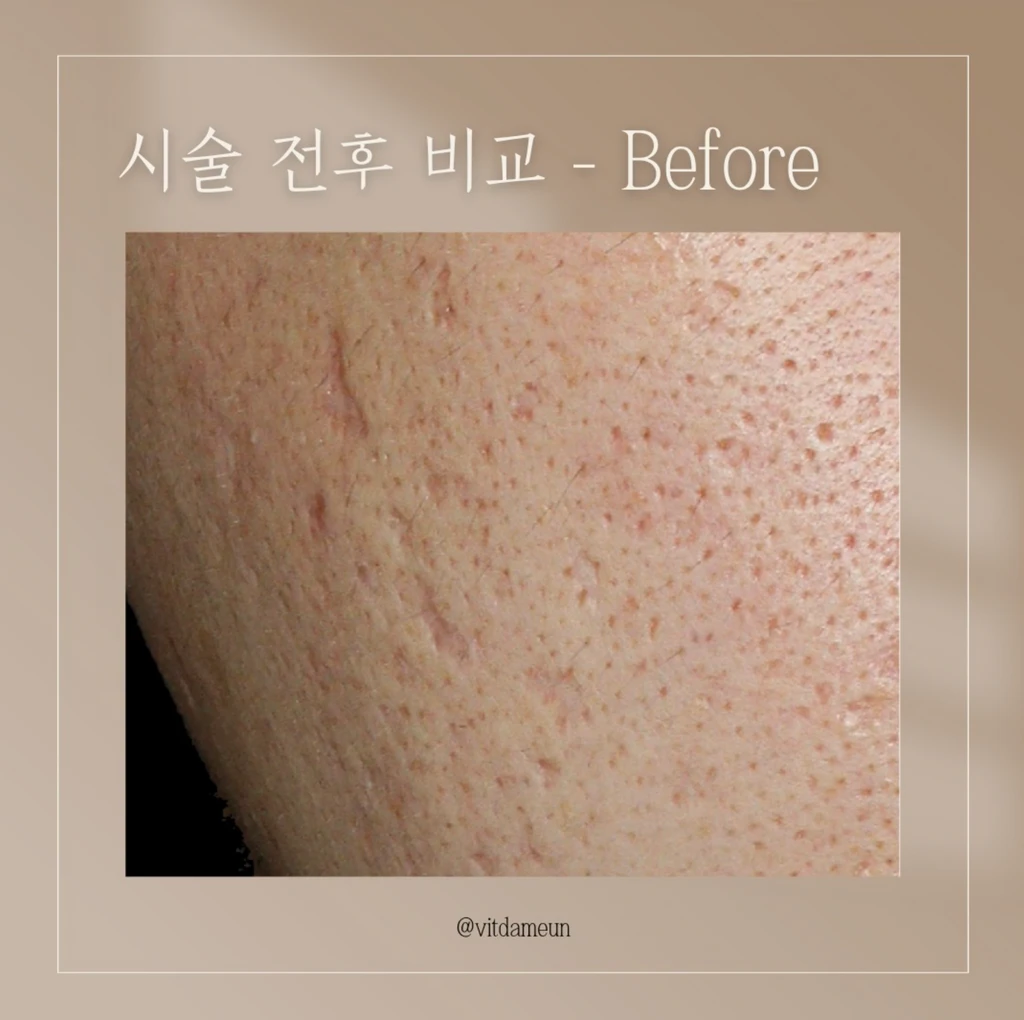 before_image