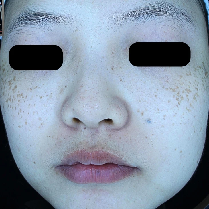 before_image