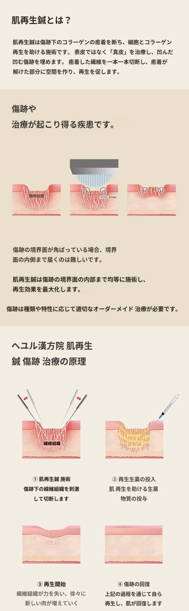 treatmentIntroduction