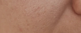 before_image