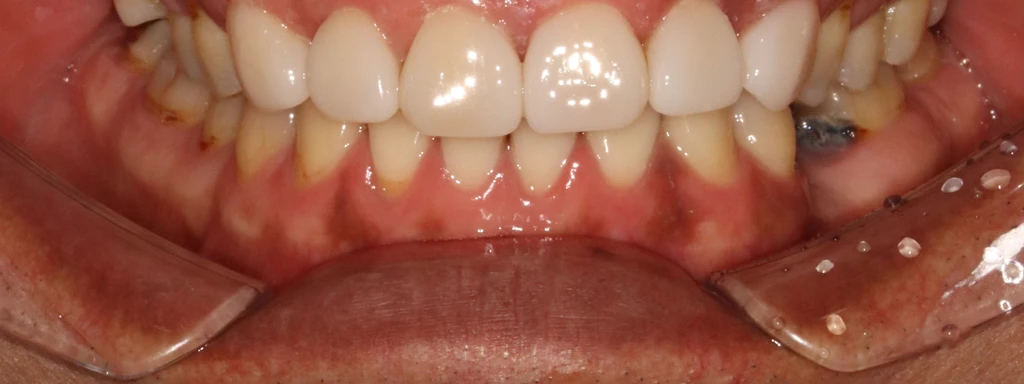 before_image