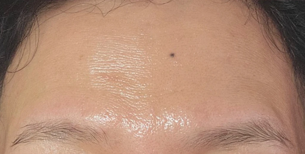 before_image