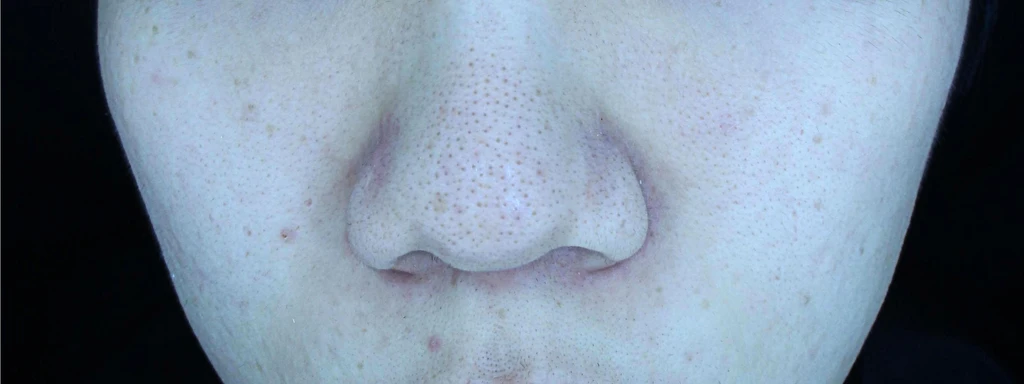 before_image