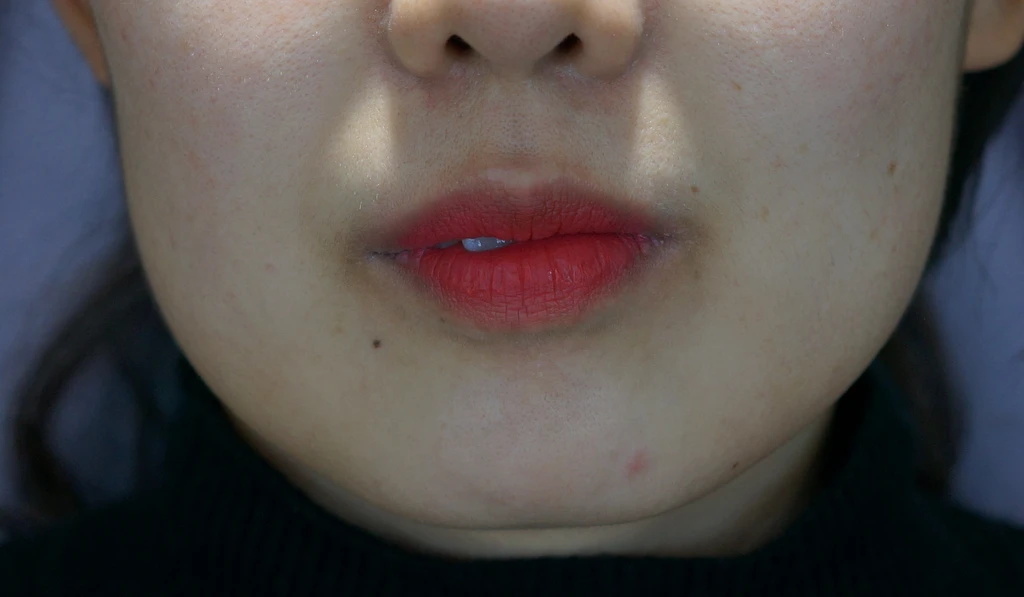 before_image