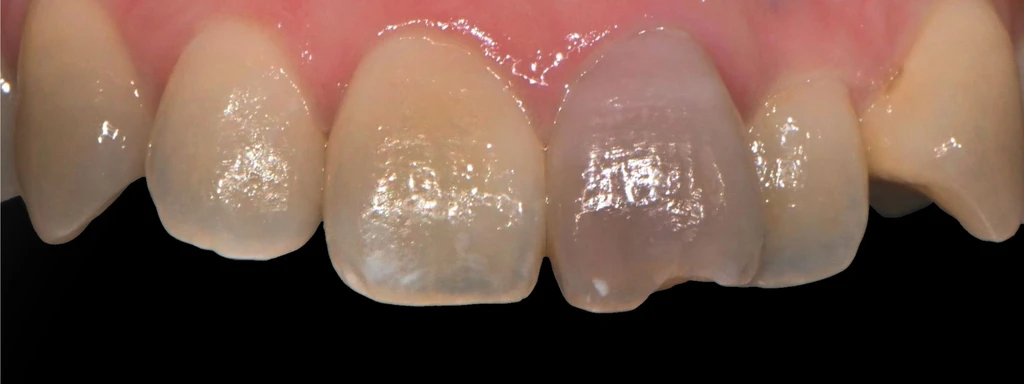 before_image