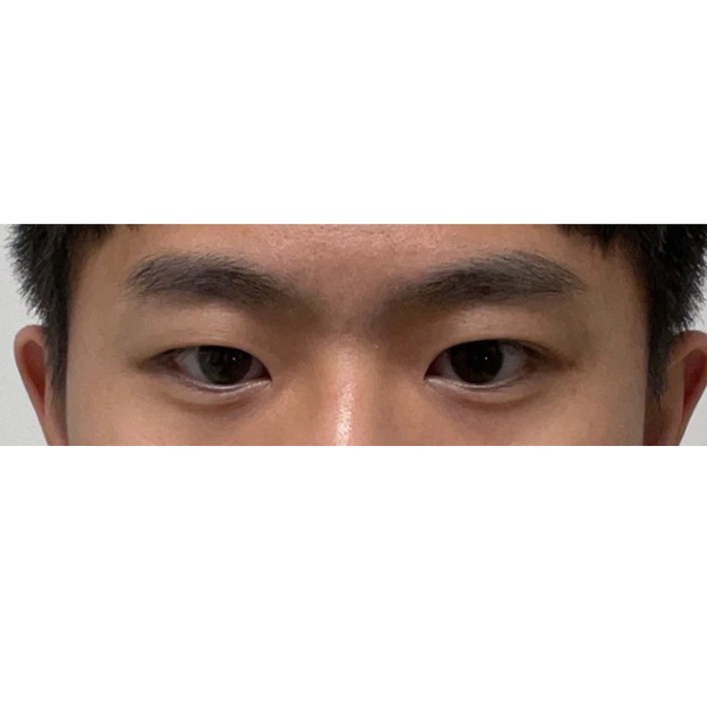 before_image