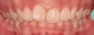 before_image