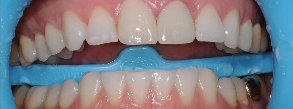 before_image