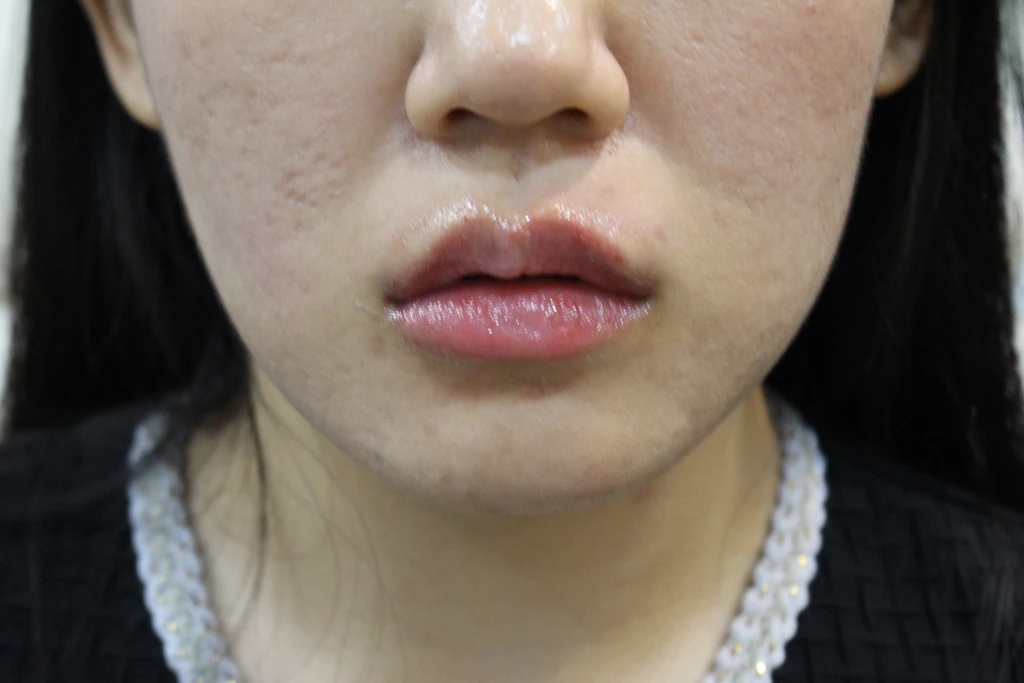 before_image