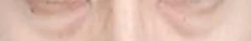 before_image