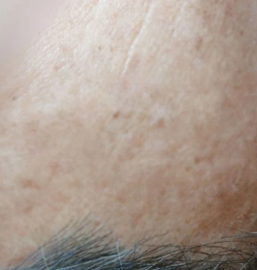 before_image