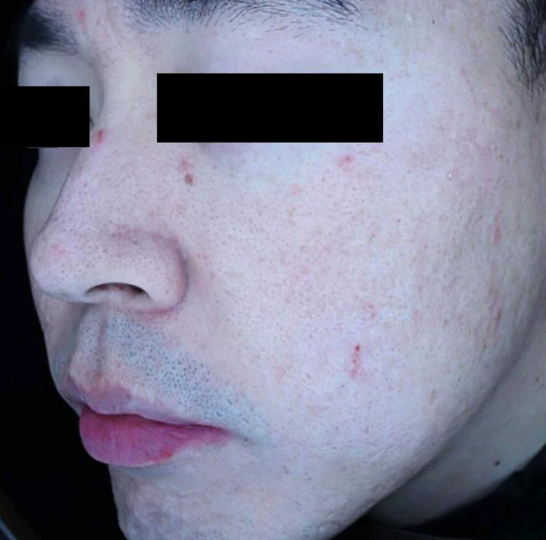 before_image