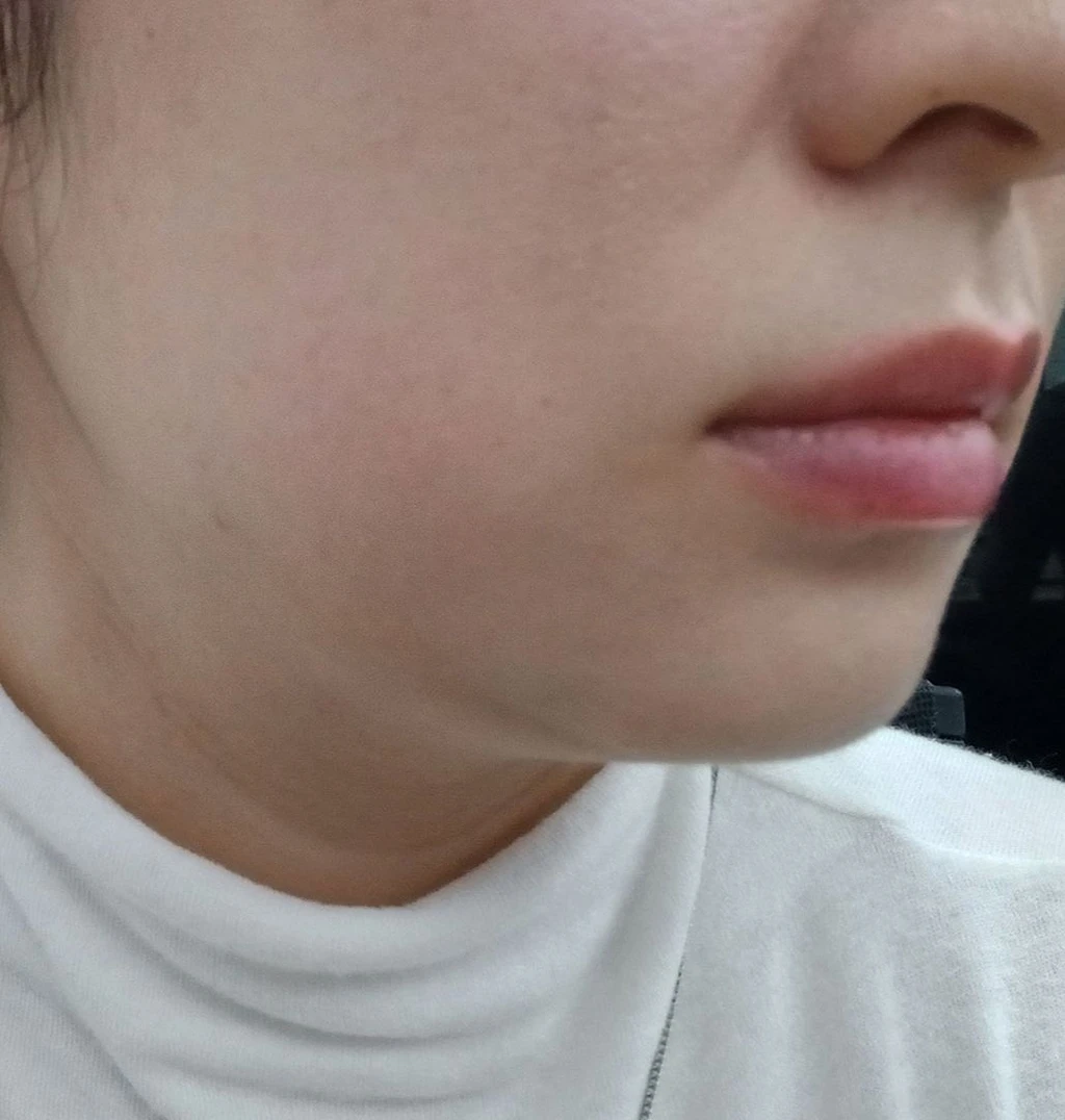 before_image