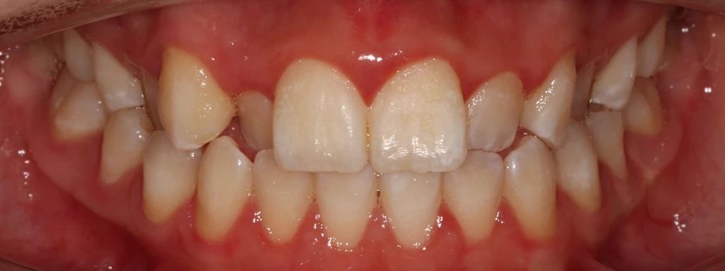 before_image