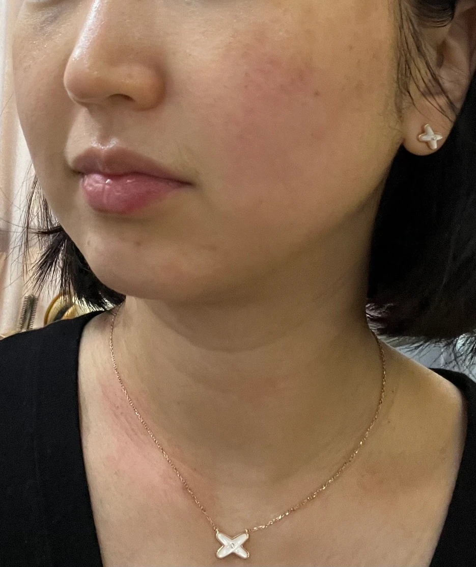 before_image