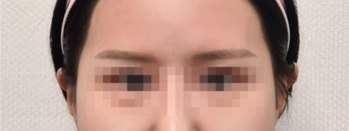 before_image