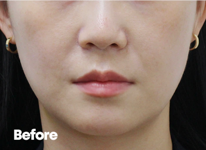 before_image