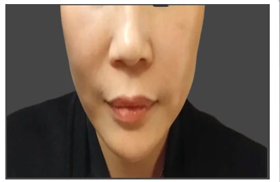 before_image
