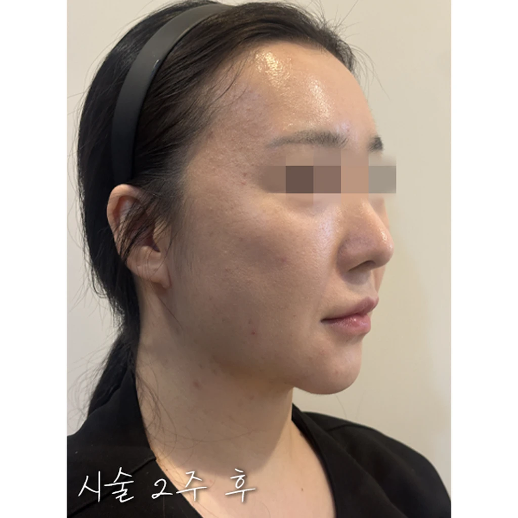before_image
