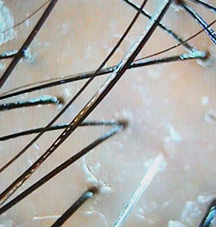 before_image